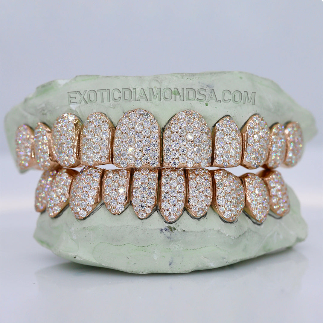Diamond Grillz