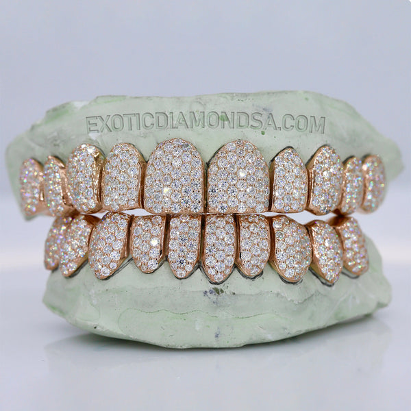 Moissanite Grillz