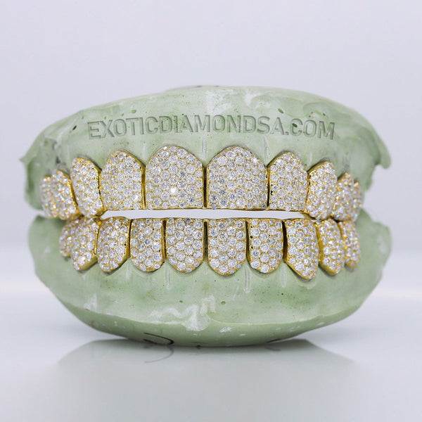 Diamond Grillz