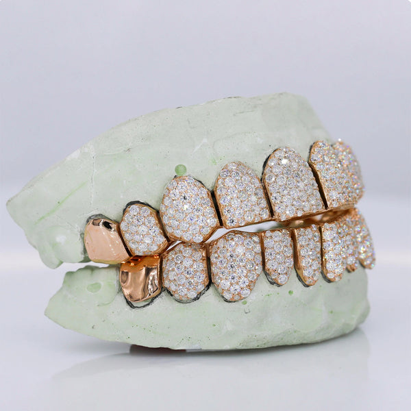 Moissanite Grillz